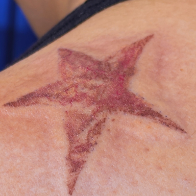 here’s a few of the birthmarks ive done recently, for my joestar promotion (stil… — tattoo by Arika Amricachi, colton, CALIFORNIA
